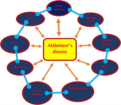 Brain Ischemia as a Prelude to Alzheimer's Disease